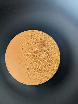  (Collemopsidium halodytes - OHa2023-08.02)  @11 [ ] by-sa (2025) Norwegian marine fungi Institute of marine research