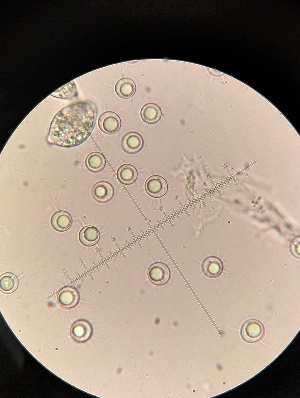  (Sphaerulina - M23KRI65060D1.2)  @11 [ ] by-sa (2025) Norwegian marine fungi Institute of marine research