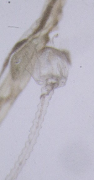  ( - NOAH0514)  @11 [ ] by-nc-sa (2025) Joan J. Soto-Angel University Museum of Bergen, Natural History Collections