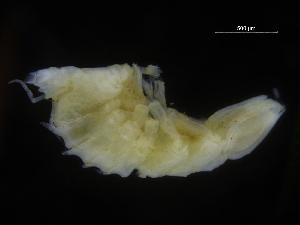  (Echinozone coronata - ZMBN_106443)  @11 [ ] CreativeCommons - Attribution Non-Commercial Share-Alike (2017) University of Bergen Natural History Collections