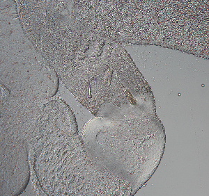  (Tetrastemma roseorhynchum - Hoplo_ETP077_SMPP0646)  @11 [ ] CreativeCommons  Attribution Non-Commercial Share-Alike (2020) Unspecified Smithsonian Tropical Research Institute
