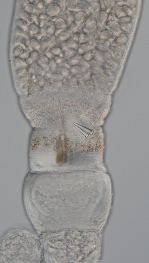  ( - Hoplo_ETP077_SMPP0845)  @11 [ ] CreativeCommons  Attribution Non-Commercial Share-Alike (2020) Unspecified Smithsonian Tropical Research Institute