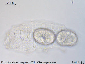  (Dianea - Tard141)  @11 [ ] Creative Commons  Attribution Non-Commercial Share-Alike (2018) NTNU University Museum, Department of Natural History NTNU University Museum, Department of Natural History