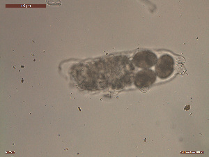  (Hypsibius convergens - Tard367)  @11 [ ] Creative Commons  Attribution Non-Commercial Share-Alike (2019) NTNU University Museum, Department of Natural History NTNU University Museum, Department of Natural History