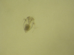  (Synchaeta pectinata - NZPL364)  @11 [ ] Copyright (2010) Ian Hogg Department of Biological Sciences, University of Waikato