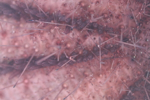  ( - NA097-044-01-A-BOL)  @11 [ ] CreativeCommons - Attribution Non-Commercial Share-Alike (2018) Tammy Norgard Ocean Exploration Trust, Northeast Pacific Seamount Expedition Partners