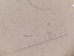  (Rhizosoleniales - IOS_31293-E1)  @11 [ ] CreativeCommons - Attribution Non-Commercial Share-Alike (2019) R. John Nelson Fisheries and Oceans Canada