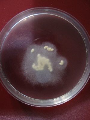  (Pythiales - LPS Steciow 204)  @11 [ ] Copyright (2016) M. Steciow Spegazzini Institute