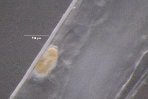  (Lecithasterinae - PZ0165)  @11 [ ] by-nc-sa (2023) Luis Martell University Museum of Bergen, Natural History Collections