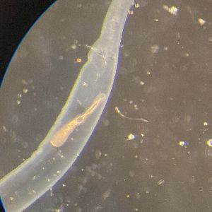  (Elytrophallinae - PZ0962)  @11 [ ] by-nc-sa (2023) Luis Martell University Museum of Bergen, Natural History Collections