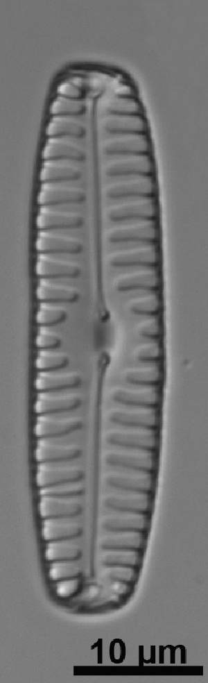  (Pinnularia catenaborealis - KATE_BLACK1)  @11 [ ] Copyright (2014) Pieter Vanormelingen Ghent University