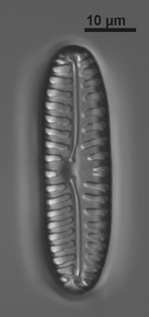  (Pinnularia borealis - VEGA L35C 20)  @11 [ ] Copyright (2014) Pieter Vanormelingen Ghent University