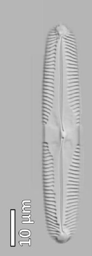  (Pinnularia parvulissima - PIN877TM)  @11 [ ] Copyright (2018) Unspecified Ghent University, Protistology and Aquatic Ecology