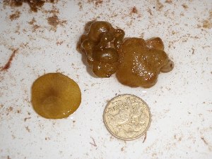  ( - GWS025180)  @11 [ ] Unspecified (default): All Rights Reserved  Unspecified Unspecified