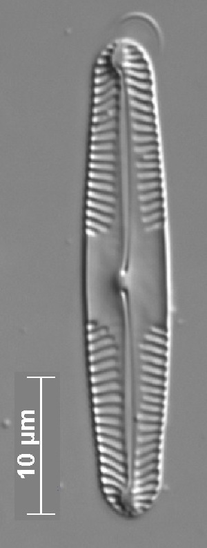  (Pinnularia acidicola var. acidicola - MIC5_16)  @11 [ ] Copyright (2014) Pieter Vanormelingen Ghent University