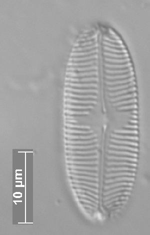  (Pinnularia brebissonii - CZECH_SWK13b)  @11 [ ] Copyright (2014) Pieter Vanormelingen Ghent University