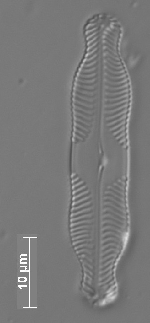  (Pinnularia grunowii - CZECH_SWK14a)  @11 [ ] Copyright (2014) Pieter Vanormelingen Ghent University