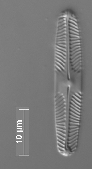  (Pinnularia krammeri - SPITS_S5_2)  @11 [ ] Copyright (2014) Pieter Vanormelingen Ghent University
