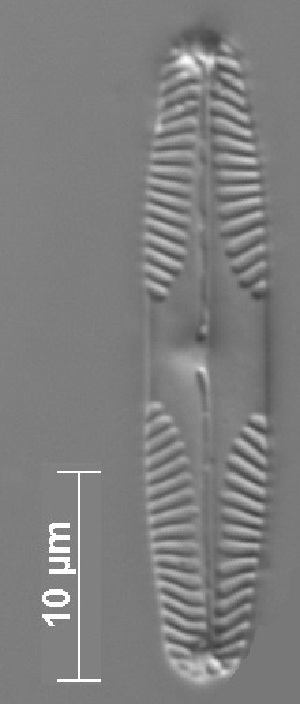  (Pinnularia microstauron - CZECH_SWK2a)  @11 [ ] Copyright (2014) Pieter Vanormelingen Ghent University