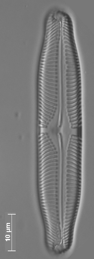  (Pinnularia rhombarea - CZECH_SW1-3)  @11 [ ] Copyright (2014) Pieter Vanormelingen Ghent University