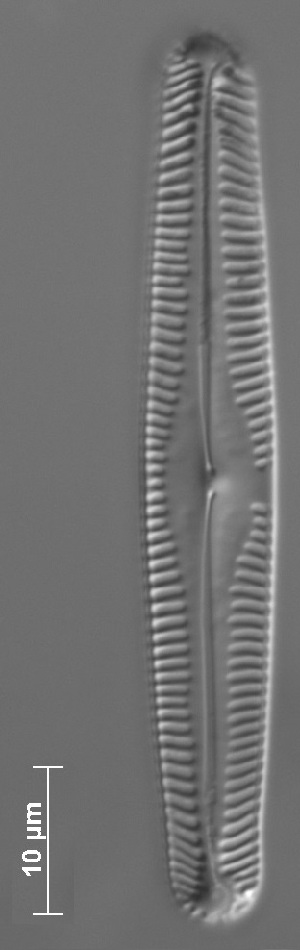  (Pinnularia cf. vixconspicua - REU12_5_1)  @11 [ ] Copyright (2014) Pieter Vanormelingen Ghent University