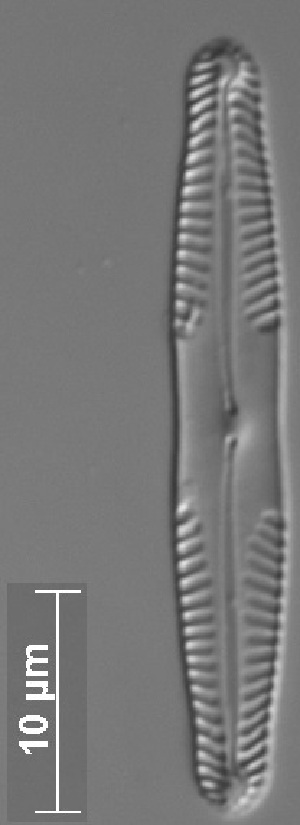  (Pinnularia cf. acidicola - REU12_9_14)  @11 [ ] Copyright (2014) Pieter Vanormelingen Ghent University