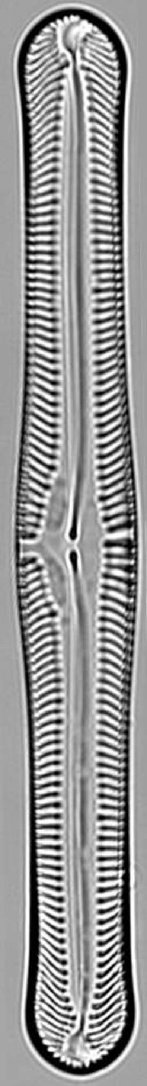  (Pinnularia macilenta - STAP3)  @11 [ ] Copyright (2017) Pieter Vanormelingen Ghent University, Protistology and Aquatic Ecology