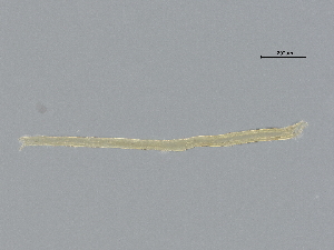  (Diplogaster - VL1N59.2)  @11 [ ] CreativeCommons - Attribution (2021) CBG Photography Group Centre for Biodiversity Genomics
