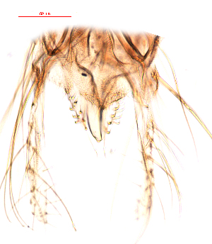  ( - song181)  @11 [ ] Copyright (2015) Chao Song College of Life Sciences, Nankai University