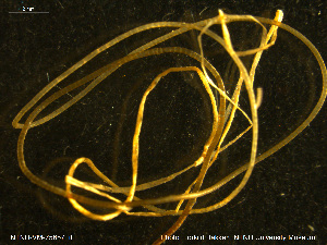  (Siboglinidae - NTNU-VM-75857)  @11 [ ] Creative Commons  Attribution Non-Commercial Share-Alike (2020) NTNU University Museum, Department of Natural History NTNU University Museum, Department of Natural History