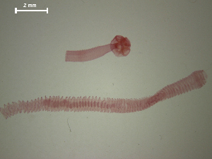  (Hymenolepidinae - 1071-692 Cloa)  @11 [ ] Copyright (2010) Sean Locke Environment Canada