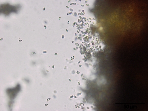  (Camarops microspora - O-F75393)  @11 [ ] CreativeCommons - Attribution Non-Commercial Share-Alike (2013) Teppo Rämä Norwegian Institute for Nature Research (NINA)