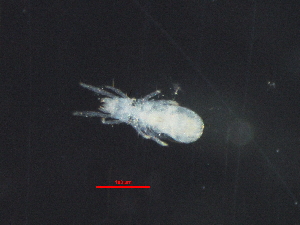 (Aphelacaridae - ADSSC_MR-6_1)  @11 [ ] CreativeCommons - Attribution Non-Commercial Share-Alike (2017) Lihu Kolton Dead Sea and Arava Science Centre