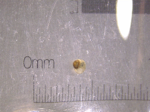  ( - 22-SNAIL-0325)  @11 [ ] CreativeCommons - Attribution Share-Alike (2023) Unspecified Drexel University, Academy of Natural Sciences