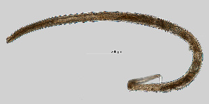  (Tripylidae - NEMA-40988-B9)  @11 [ ] by-nc (2023) Oleksandr Holovachov Swedish Museum of Natural History