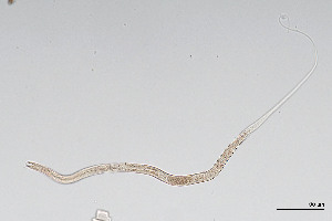  (Prismatolaimidae - NEMA-40989-C4)  @11 [ ] by-nc (2024) Oleksandr Holovachov Swedish Museum of Natural History