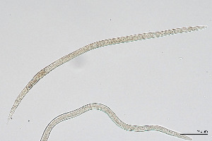  (Anguinidae - NEMA-40991-A8)  @11 [ ] by-nc (2024) Oleksandr Holovachov Swedish Museum of Natural History
