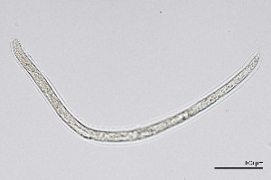  (Diphtherophoridae - NEMA-40991-B4)  @11 [ ] by-nc (2024) Oleksandr Holovachov Swedish Museum of Natural History