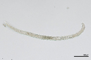  (Diphtherophoridae - NEMA-40991-B6)  @11 [ ] by-nc (2024) Oleksandr Holovachov Swedish Museum of Natural History