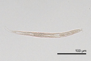  (Wilsonematinae - NEMA-40991-D3)  @11 [ ] by-nc (2024) Oleksandr Holovachov Swedish Museum of Natural History