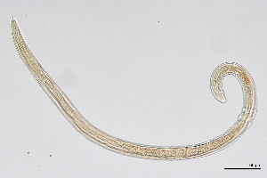  (Dorylaimidae - NEMA-40991-H5)  @11 [ ] by-nc (2024) Oleksandr Holovachov Swedish Museum of Natural History