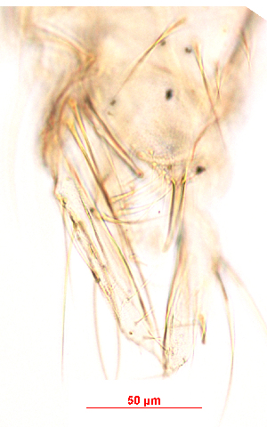  (Polypedilum sp. 7SC - song204)  @11 [ ] Copyright (2015) Chao Song Nankai University