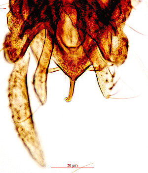  (Polypedilum depile - song43)  @11 [ ] Copyright (2015) Chao Song Nankai University