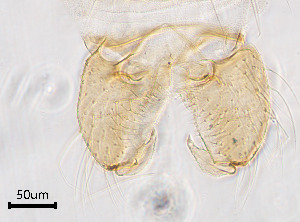 (Procladius sp. 2XL - sun433)  @12 [ ] CreativeCommons - Attribution Non-Commercial Share-Alike (2020) Xiaolong Lin College of Life Sciences, Nankai Unviersity
