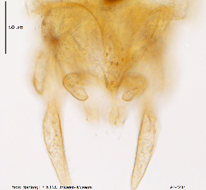  (Tanytarsus riopreto cf - FA7-42)  @11 [ ] CreativeCommons - Attribution Non-Commercial Share-Alike (2015) NTNU University Museum, Department of Natural History NTNU University Museum, Department of Natural History