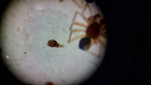  ( - ABOL-24-1342)  @11 [ ] Unspecified (default): All Rights Reserved (2025) Johannes Schall Unspecified