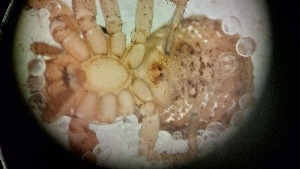  ( - ABOL-24-1344)  @11 [ ] Unspecified (default): All Rights Reserved (2025) Johannes Schall Unspecified