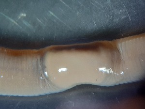  ( - ABOL-25-0323)  @11 [ ] Unspecified (default): All Rights Reserved (2025) Edith Gruber Unspecified