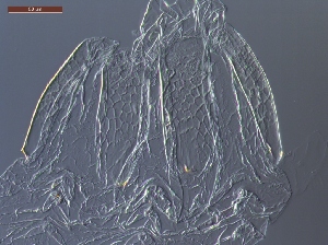  (Anoplotermes reticuladotus - UF_BO997)  @11 [ ] Copyright (2014) Rudolf Scheffrahn University of Florida