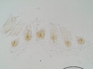  (Aparatermes thornatus - UF_FG464.1)  @11 [ ] Copyright (2014) Rudolf Scheffrahn University of Florida